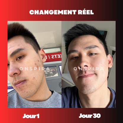 OnSpira Baguette Lumière Rouge 4-en-1