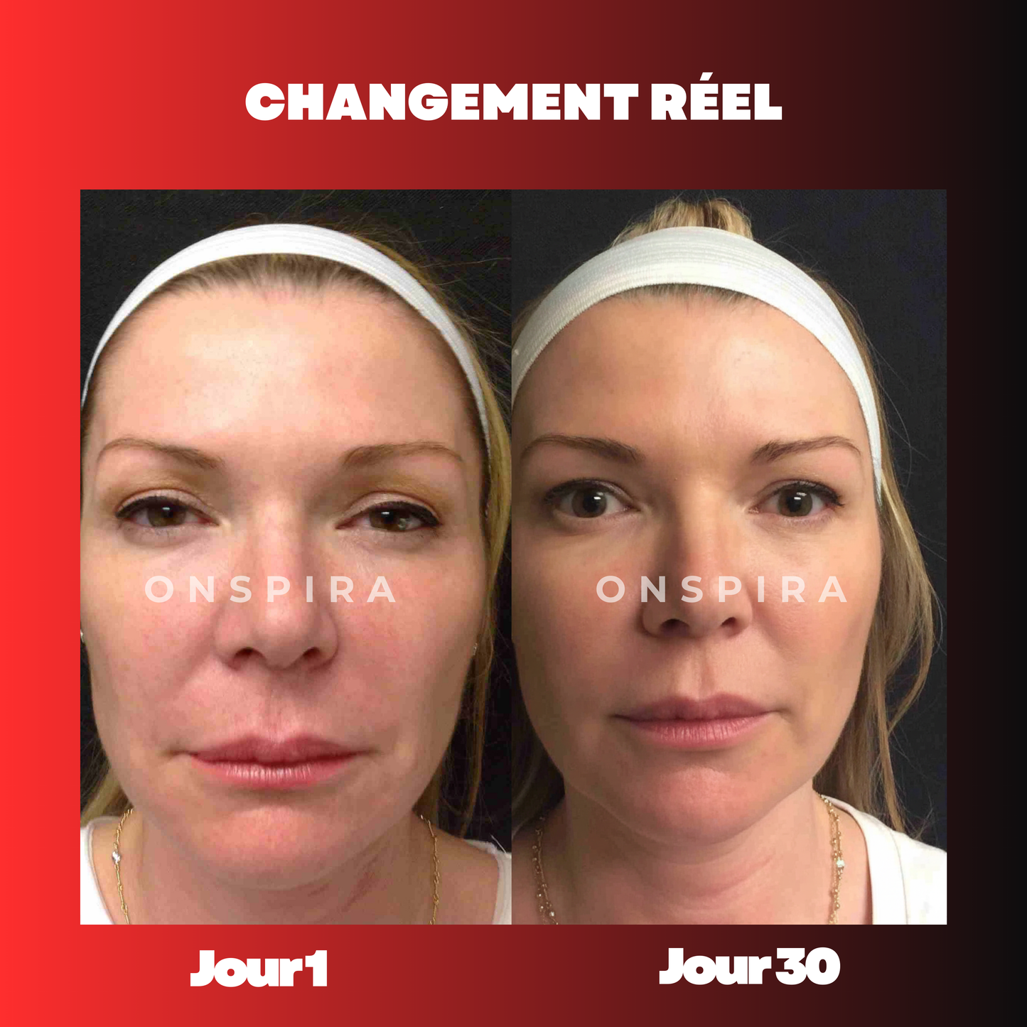 OnSpira Baguette Lumière Rouge 4-en-1